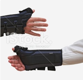 Prosthetic Hand