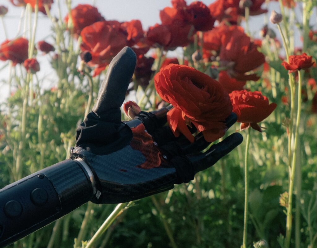 Amputee Negative Body Image Show Off Your Prosthesis to Lift Your Spirits