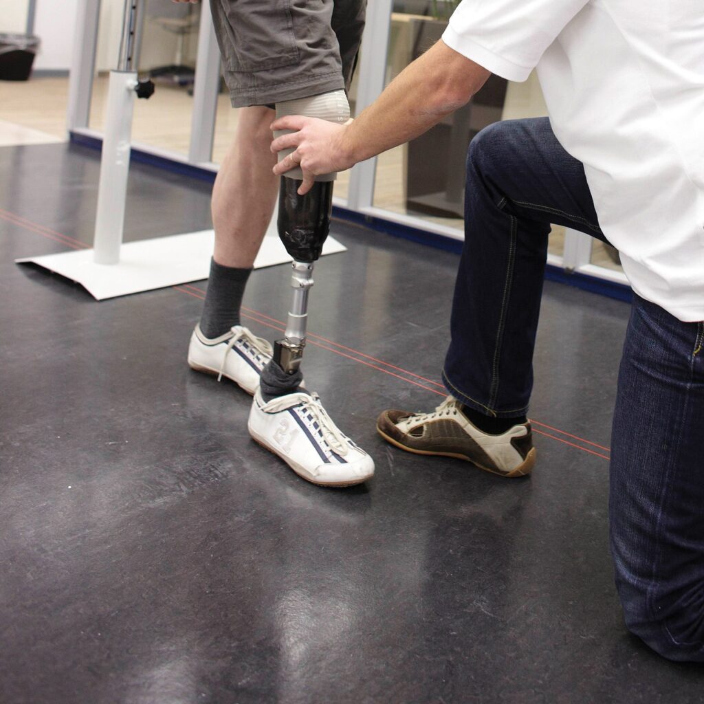 Guidance on Selecting the Right Prosthetist