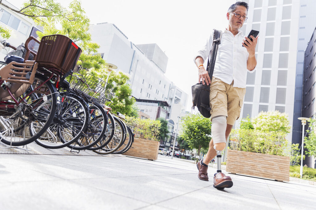 Prosthetic Replacement - How Often Should an Amputee Replace Their Prosthesis?